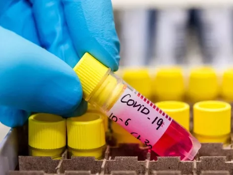 WHO has canceled the COVID-19 pandemic status: how the disease has affected the world and what will happen now